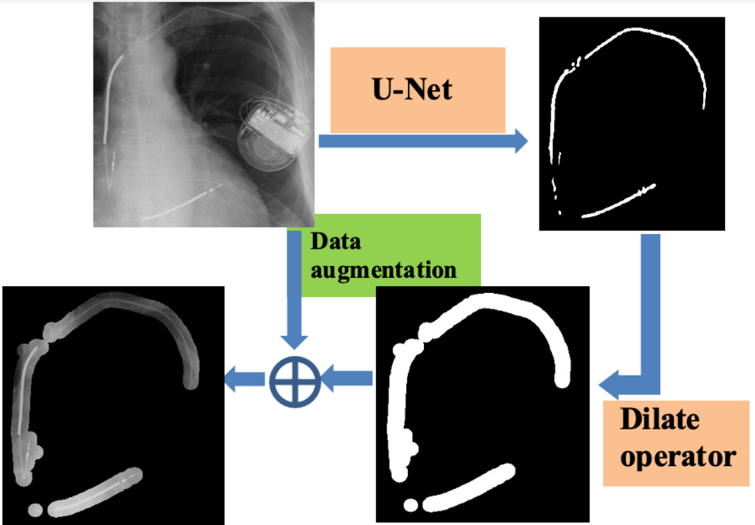 Automatic Detection of Coil Position in the Chest Xray Images for